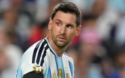 Qué le pasó a Lionel Messi debajo del ojo en el partido contra Suiza