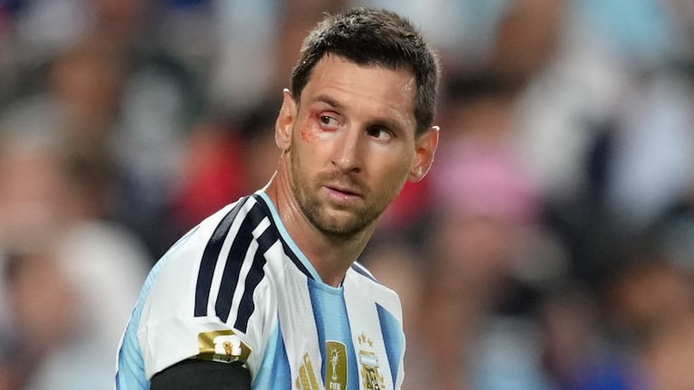 que-le-paso-a-lionel-messi-debajo-del-ojo-en-el-partido-contra-suiza-20260712-030813